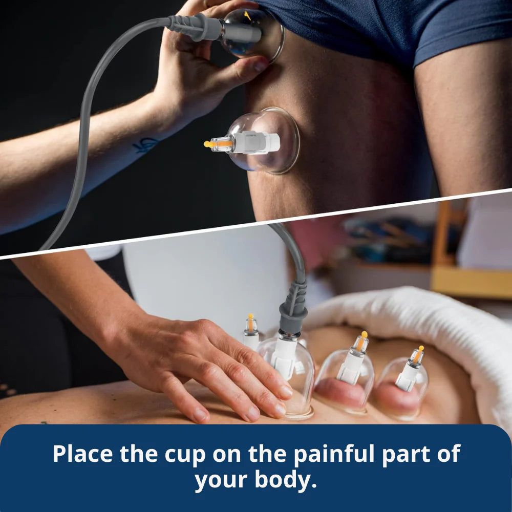 Cupping Therapy Set