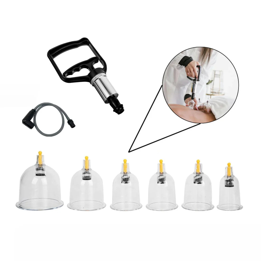 Cupping Therapy Set
